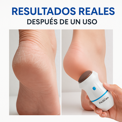 PediCare™ Adiós a durezas y pies resecos en minutos